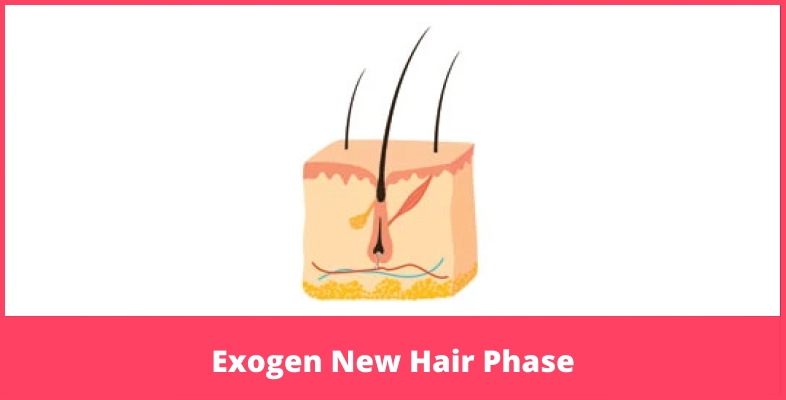 Exogen New Hair Phase