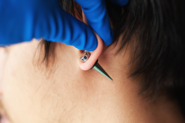 How To Treat Cartilage Piercing Infection