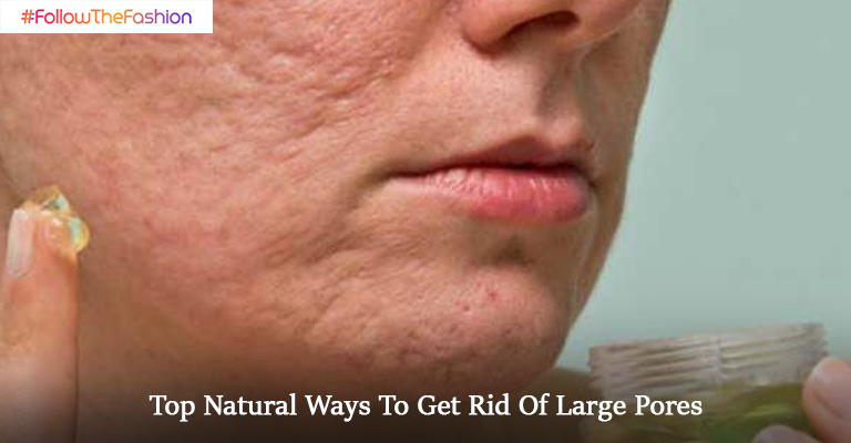 Natural Ways To Get Rid Of Large Pores