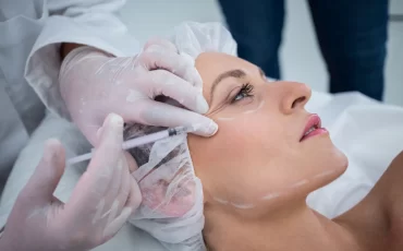 Dermal Fillers